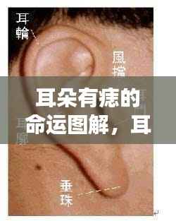 耳朵痣相图解,揭示星相与人生轨迹的神秘联系,命运解读新篇章