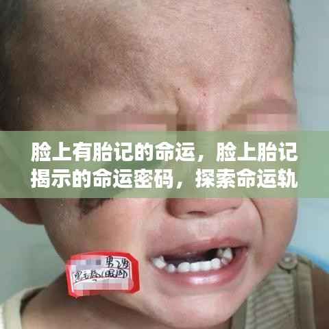 脸上胎记与命运密码,揭示命运轨迹的独特印记探索