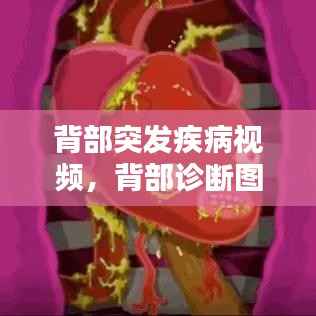 背部突发疾病视频,背部诊断图