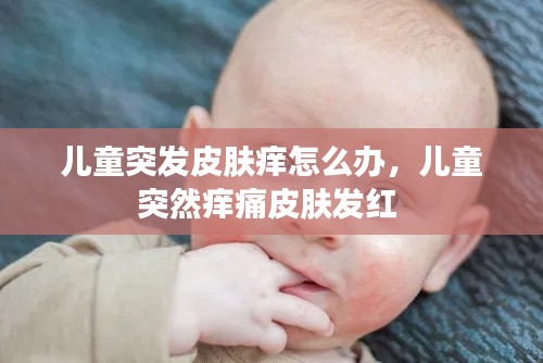 儿童突发皮肤痒怎么办,儿童突然痒痛皮肤发红